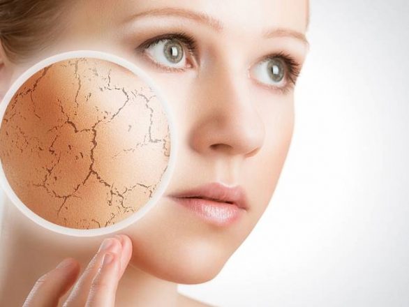 خشکی پوست در فصل پاییز و تدابیر طب سنتی 4 خشکی پوست