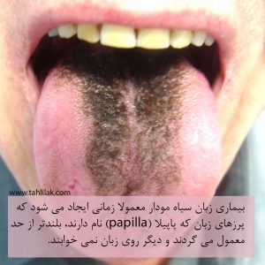 Black Hairy Tongue SQ 1159 1