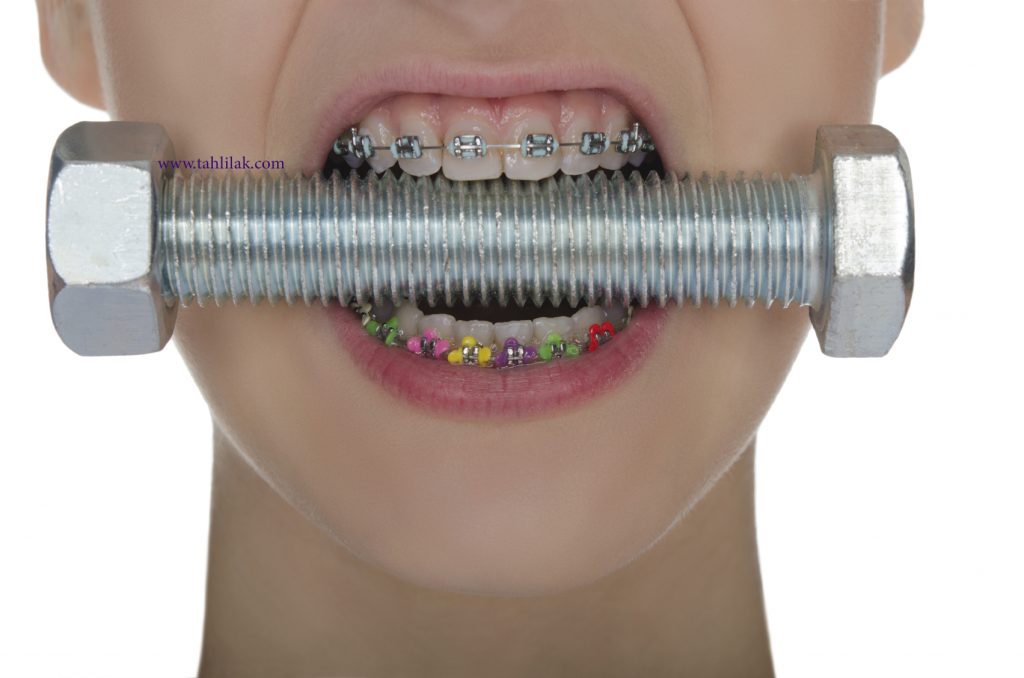 iStock 000035756296 Medium